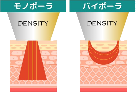 2種類のRF同時照射で、持続的＆即時的効果